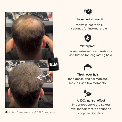 Instant Confidence for Thinning Hair