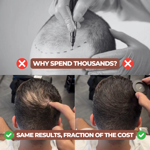 The Best Alternative To Expensive Procedures